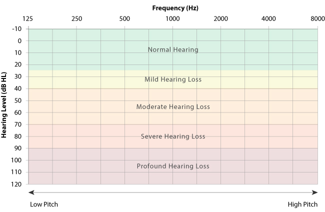 Hearing Test Audiogram
